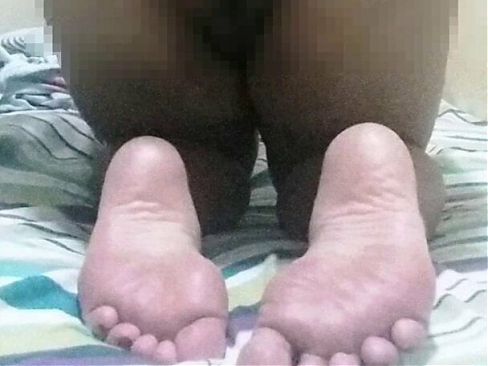 Toes or soles?